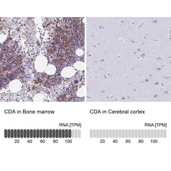 Citidine Deaminase Antibody, Novus Biologicals:Antibodies:Primary Antibodies